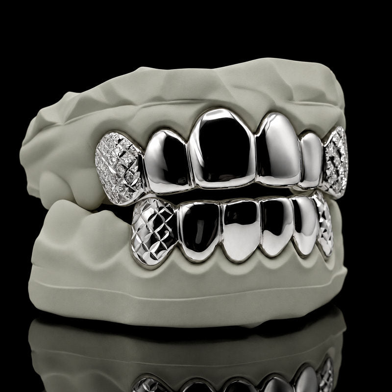 Tae's Imperial Gold 925 silver grillz on a dental model