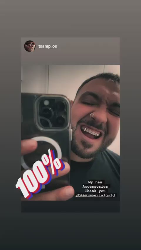 Customer showing his Tae's Imperial Gold grillz