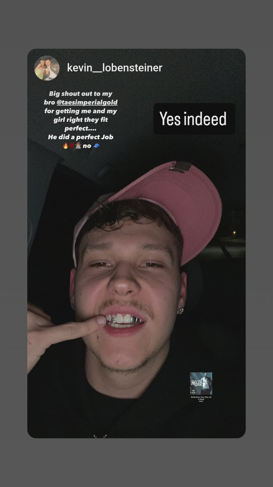 Customer showing his Tae's Imperial Gold grillz