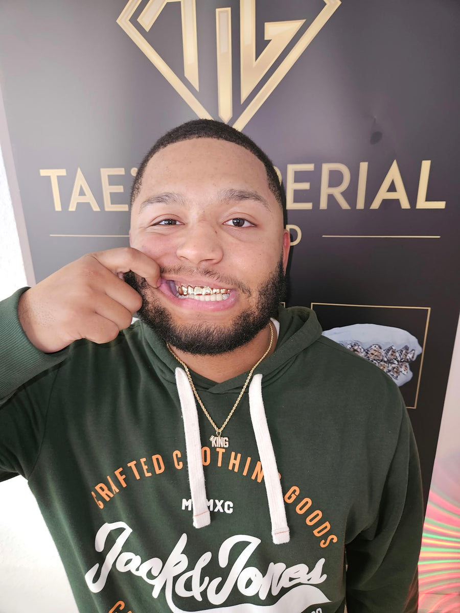 Customer wearing gold grillz in front of the Tae's Imperial Gold backdrop