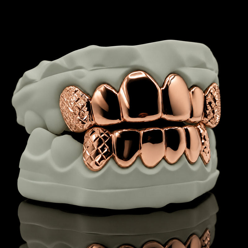 Rose gold plated deep cut set on a dental model
